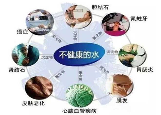 5a净水云仓,中山净水器